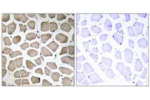 Immunohistochemistry analysis of paraffin-embedded human skeletal muscle tissue using MOT12 Antibody . (SLC16A12 抗体)