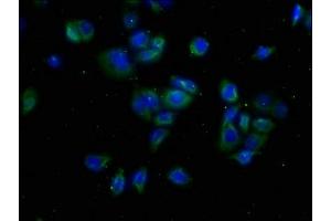 Immunofluorescence staining of PC-3 cells with ABIN7175608 at 1:50, counter-stained with DAPI. (CACNA1A 抗体  (AA 1838-2136))