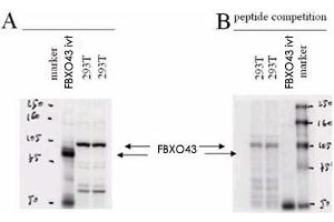 Western blot using FBXO43 polyclonal antibody . (FBXO43 抗体  (N-Term))