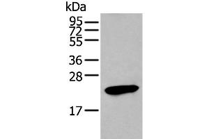 Western blot analysis of Human stomach tissue lysate using GKN1 Polyclonal Antibody at dilution of 1:250 (Gastrokine 1 抗体)