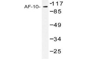 Western blot (WB) analysis of AF-10 antibody in extracts from COLO205 cells. (MLLT10 抗体)