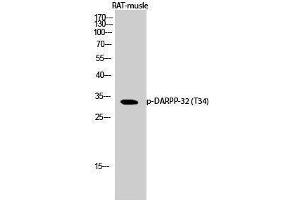 Western Blotting (WB) image for anti-Protein Phosphatase 1, Regulatory (Inhibitor) Subunit 1B (PPP1R1B) (pThr34) antibody (ABIN3179790) (DARPP32 抗体  (pThr34))