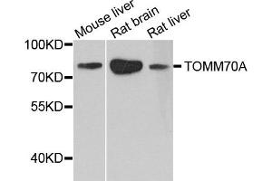 Western blot analysis of extract of various cells, using TOM70 antibody. (TOM70 抗体)
