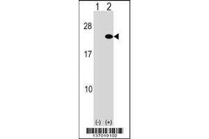 Western blot analysis of ARF5 using rabbit polyclonal ARF5 Antibody using 293 cell lysates (2 ug/lane) either nontransfected (Lane 1) or transiently transfected (Lane 2) with the ARF5 gene. (ARF5 抗体  (AA 80-108))
