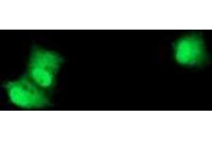 Anti-RPS6KB1 mouse monoclonal antibody (ABIN2454594) immunofluorescent staining of COS7 cells transiently transfected by pCMV6-ENTRY RPS6KB1 (RC217324). (RPS6KB1 抗体)