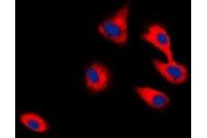 Immunofluorescent analysis of CADM2 staining in HepG2 cells. (CADM2 抗体)