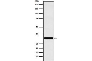 Western blot analysis of RAB27A expression in MCF-7 cell lysate.
