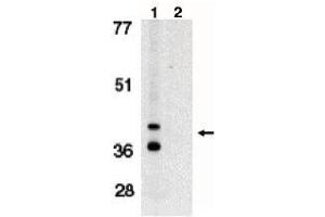 Image no. 1 for anti-BCL2/adenovirus E1B 19kDa Interacting Protein 3-Like (BNIP3L) (AA 77-92) antibody (ABIN264993) (BNIP3L/NIX 抗体  (AA 77-92))
