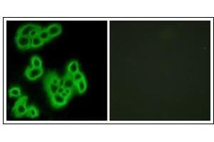 Immunofluorescence analysis of MCF7 cells, using FPR1 Antibody. (FPR1 抗体)
