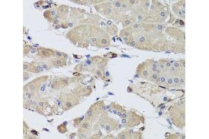 Immunohistochemistry of paraffin-embedded Human stomach using FABP5 Polyclonal Antibody at dilution of 1:100 (40x lens). (FABP5 抗体)