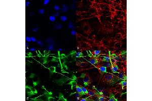 Immunocytochemistry/Immunofluorescence analysis using Mouse Anti-GluN2A/NR2A Monoclonal Antibody, Clone S327-95 (ABIN2483881). (NMDAR2A 抗体  (AA 75-325) (HRP))