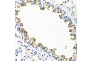 Immunohistochemistry of paraffin-embedded mouse lung using TICAM1 antibody. (TICAM1 抗体  (AA 20-200))