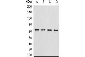 Western blot analysis of Gc-globulin expression in A549 (A), A375 (B), SHSY5Y (C), mouse liver (D) whole cell lysates. (Vitamin D-Binding Protein 抗体)