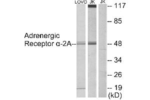 Immunohistochemistry analysis of paraffin-embedded human testis tissue using Adrenergic Receptor α-2A antibody. (ADRA2A 抗体  (Internal Region))