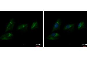 ICC/IF Image Autotaxin antibody detects Autotaxin protein at cytoplasm by immunofluorescent analysis. (ENPP2 抗体  (C-Term))