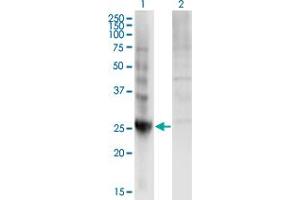 Western Blot analysis of DIRAS3 expression in transfected 293T cell line by DIRAS3 monoclonal antibody (M01A), clone 1G4. (DIRAS3 抗体  (AA 130-229))