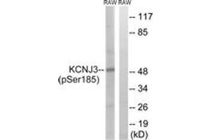 Western Blotting (WB) image for anti-Potassium Inwardly-Rectifying Channel, Subfamily J, Member 3 (KCNJ3) (AA 151-200), (pSer185) antibody (ABIN1531648)