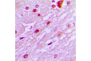 Immunohistochemical analysis of DBF4 staining in human brain formalin fixed paraffin embedded tissue section. (DBF4 抗体  (N-Term))