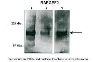 Human sperm and mouse liver (RAPGEF2 抗体  (Middle Region))