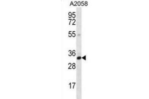 Western Blotting (WB) image for anti-Calponin 2 (CNN2) antibody (ABIN2996730) (CNN2 抗体)