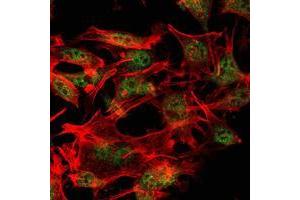 Immunofluorescence analysis of LOVO cells using SETDB1 mouse mAb (green). (SETDB1 抗体)