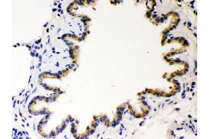 Anti- COMT Picoband antibody, IHC(P) IHC(P): Rat Lung Tissue (COMT 抗体  (AA 52-271))