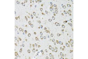 Immunohistochemistry of paraffin-embedded mouse brain using OGDH antibody (ABIN6292773) at dilution of 1:100 (40x lens). (alpha KGDHC 抗体)