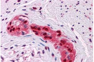 Human Colon, myenteric plexus: Formalin-Fixed, Paraffin-Embedded (FFPE) (SOX9 抗体  (AA 400-510))