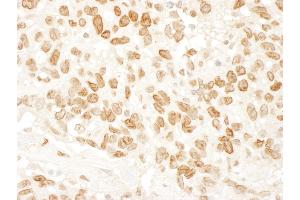 anti-RBP1-like protein (ARID4B) (AA 125-175) antibody