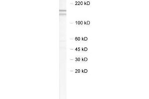 dilution: 1 : 1000, sample: brain homogenate of 5 x FAD mouse (NEDD4-2 抗体)