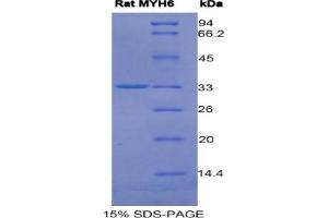 SDS-PAGE analysis of Rat MYH6 Protein. (MYH6 蛋白)
