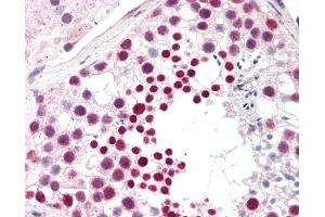 Immunohistochemistry (IHC) image for anti-Cancer/testis Antigen 1B (CTAG1B) (C-Term) antibody (ABIN6755388)