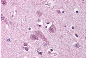 Human Brain, Cortex (formalin-fixed, paraffin-embedded) stained with MARK1 antibody ABIN239803 at 2. (MARK1 抗体  (N-Term))