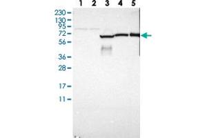 Western blot analysis of Lane 1: RT-4, Lane 2: U-251 MG, Lane 3: Human Plasma, Lane 4: Liver, Lane 5: Tonsil with GAB3 polyclonal antibody . (GAB3 抗体)
