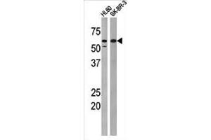 The anti-Phospho-MYT1- Antibody (ABIN389599 and ABIN2839610) is used in Western blot to detect Phospho-MYT1- in HL60 (left) and SK-BR-3 (right) tissue lysates.