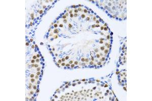 Immunohistochemistry of paraffin-embedded mouse testis using DDX46 antibody  at dilution of 1:100 (40x lens).