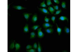 Immunofluorescence staining of A549 cells with ABIN7160149 at 1:133, counter-stained with DAPI. (ABHD6 抗体  (AA 105-211))