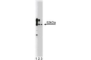 Western Blotting (WB) image for anti-Calcium/calmodulin-Dependent Protein Kinase II alpha (CAMK2A) (AA 448-460) antibody (ABIN968458) (CAMK2A 抗体  (AA 448-460))