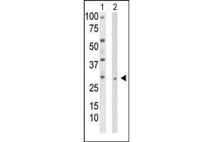The anti-TK2 Pab (ABIN1882141 and ABIN2841224) is used in Western blot to detect TK2 in HepG2 cell lysate (Lane 1) and mouse liver tissue lysate (Lane 2). (TK2 抗体  (N-Term))