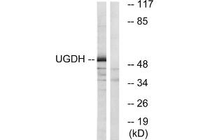 Western blot analysis of extracts from COLO cells, using UGDH antibody. (UGDH 抗体  (C-Term))