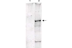 Image no. 1 for anti-Ataxia Telangiectasia Mutated (ATM) (pSer1981) antibody (ABIN401482) (ATM 抗体  (pSer1981))