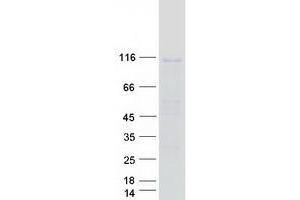 Validation with Western Blot