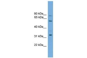 WB Suggested Anti-PTDSS2 Antibody Titration:  0. (PTDSS2 抗体  (Middle Region))