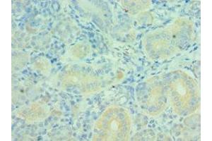 Immunohistochemistry of paraffin-embedded human pancreatic tissue using ABIN7160627 at dilution of 1:100 (MTM1 抗体  (AA 484-603))
