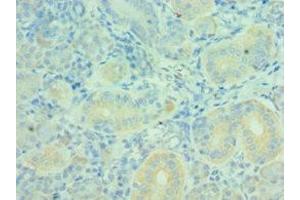 Immunohistochemistry of paraffin-embedded human pancreatic tissue using ABIN7160627 at dilution of 1:100 (MTM1 抗体  (AA 484-603))