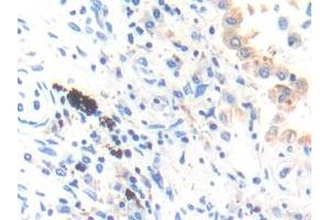 Immunohistochemistry (IHC) image for anti-Cathepsin K (CTSK) (AA 54-317) antibody (ABIN7441856)