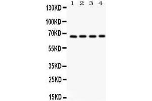 Western Blotting (WB) image for anti-Optineurin (OPTN) (AA 241-577) antibody (ABIN3042498) (OPTN 抗体  (AA 241-577))