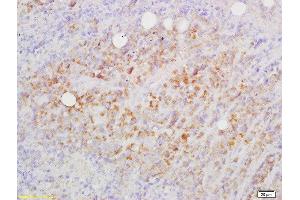 Formalin-fixed and paraffin embedded mouse lymphoma labeled with Rabbit Anti-CD82/KAI1 Polyclonal Antibody, Unconjugated  at 1:200 followed by conjugation to the secondary antibody and DAB staining (CD82 抗体  (AA 165-267))