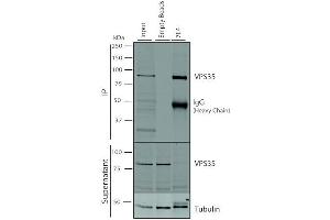 Immunoprecipitation analysis using Mouse Anti-VPS35 Monoclonal Antibody, Clone 7E4 (ABIN6932920). (VPS35 抗体  (Biotin))