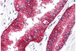 Immunohistochemistry (Formalin/PFA-fixed paraffin-embedded sections) of human prostate tissue with KCNN4 polyclonal antibody . (KCNN4 抗体  (C-Term))